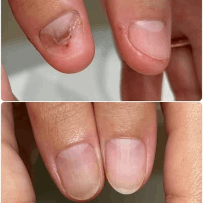 Natural Nail & Foot Wellness Guide