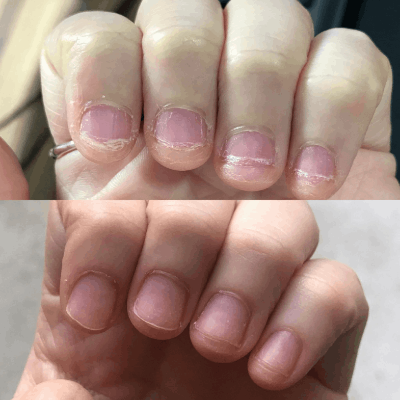 Natural Nail & Foot Wellness Guide