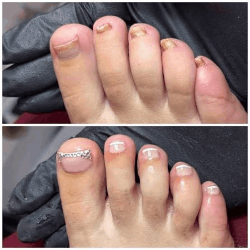 Natural Nail & Foot Wellness Guide